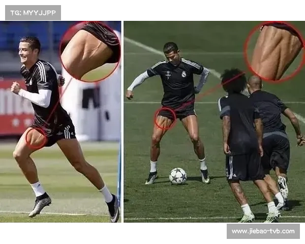 里尔19岁中场伊唐·姆巴佩大腿受伤，伤缺时间未明